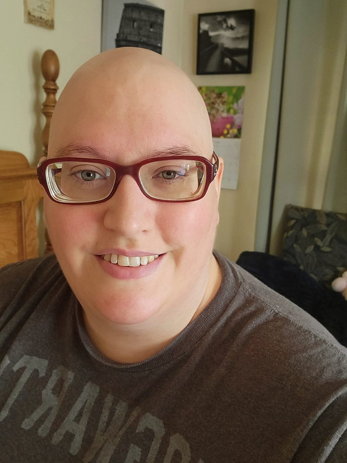 After I Started Chemo Treatment I Lost All My Hair But My Dad Did  A Great Job Shaving My Head So that I Didn't Have To Keep Watching It Fall Out