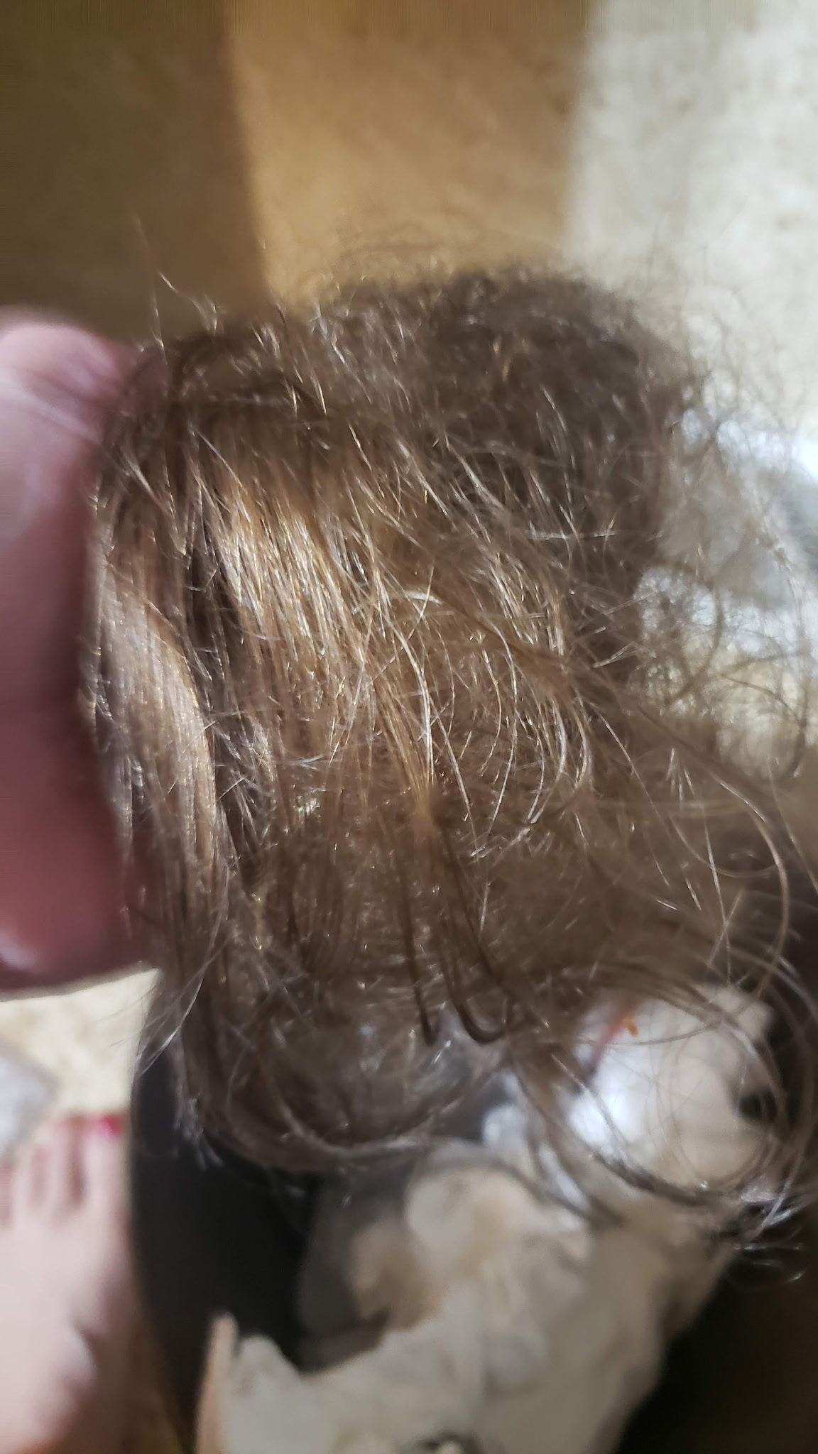 Julie's Natural Hair Fell Out in Clumps