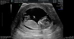 A Picture of Our Sweet Little Brother