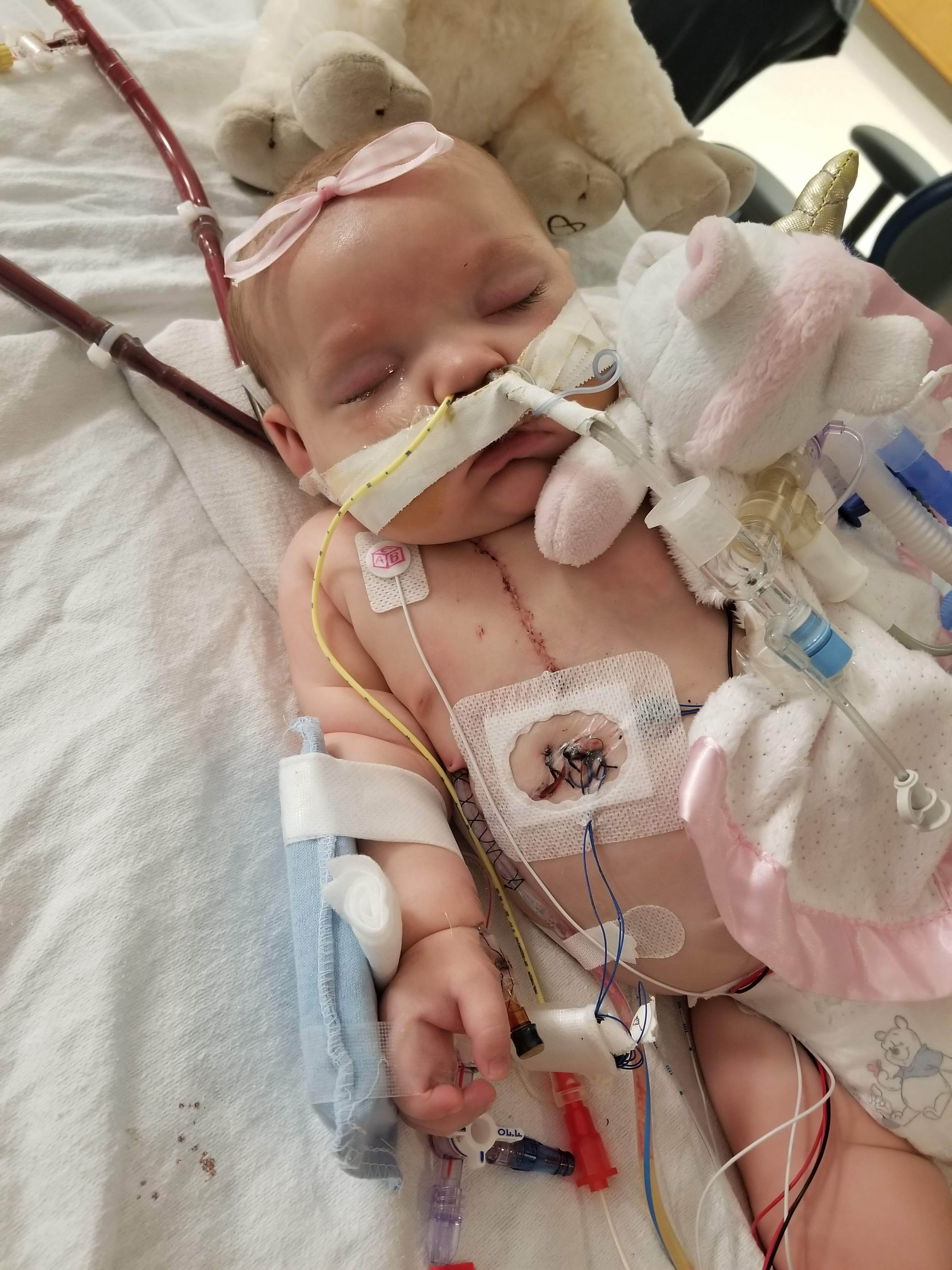 After 2nd open heart at 3 months old, still on ECMO