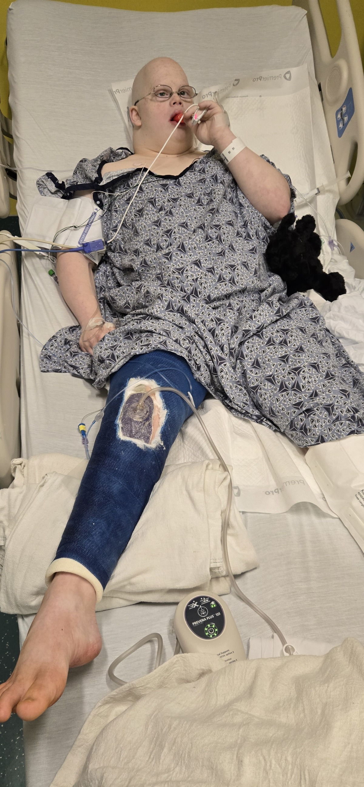 Tumor Removal & Knee Replacement implant