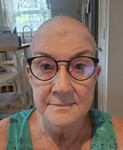 Currently bald & battling!