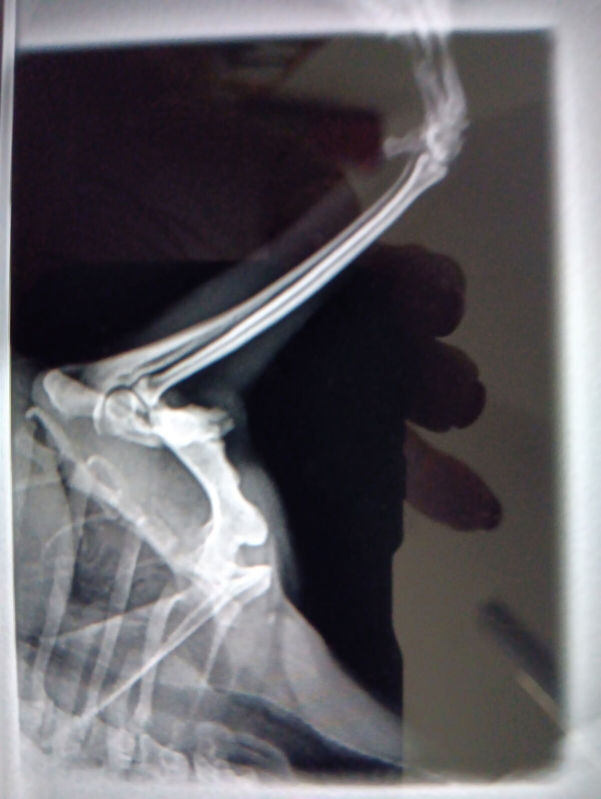 Jimothy's X-Ray