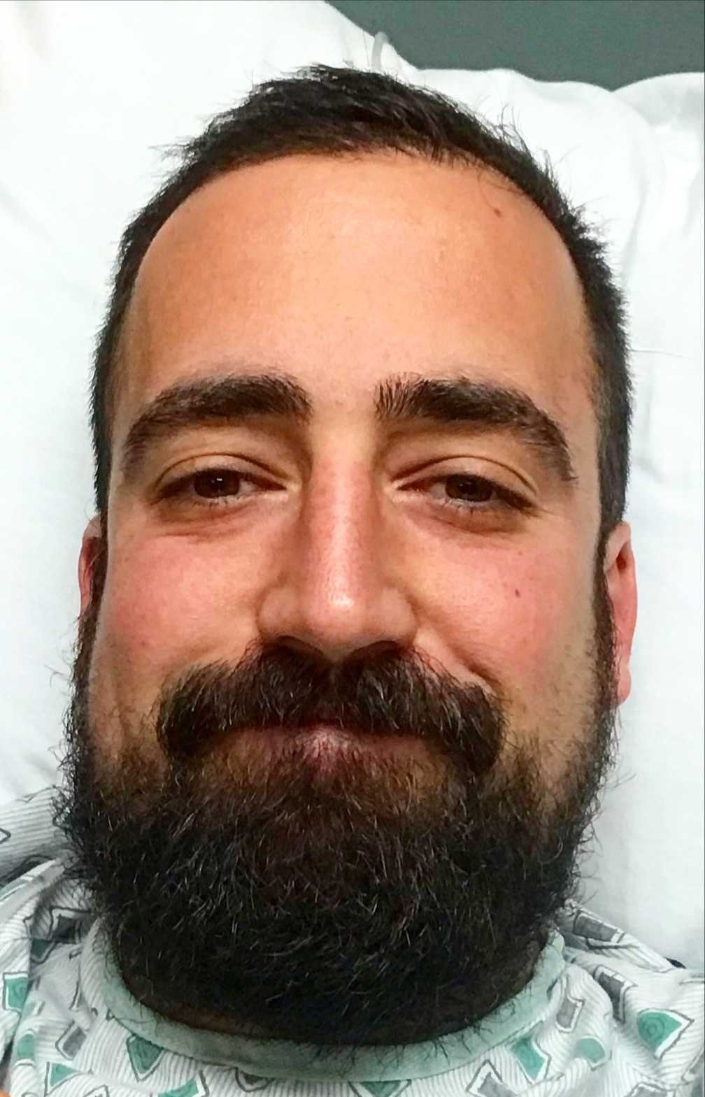 The Post-Colonoscopy full beard