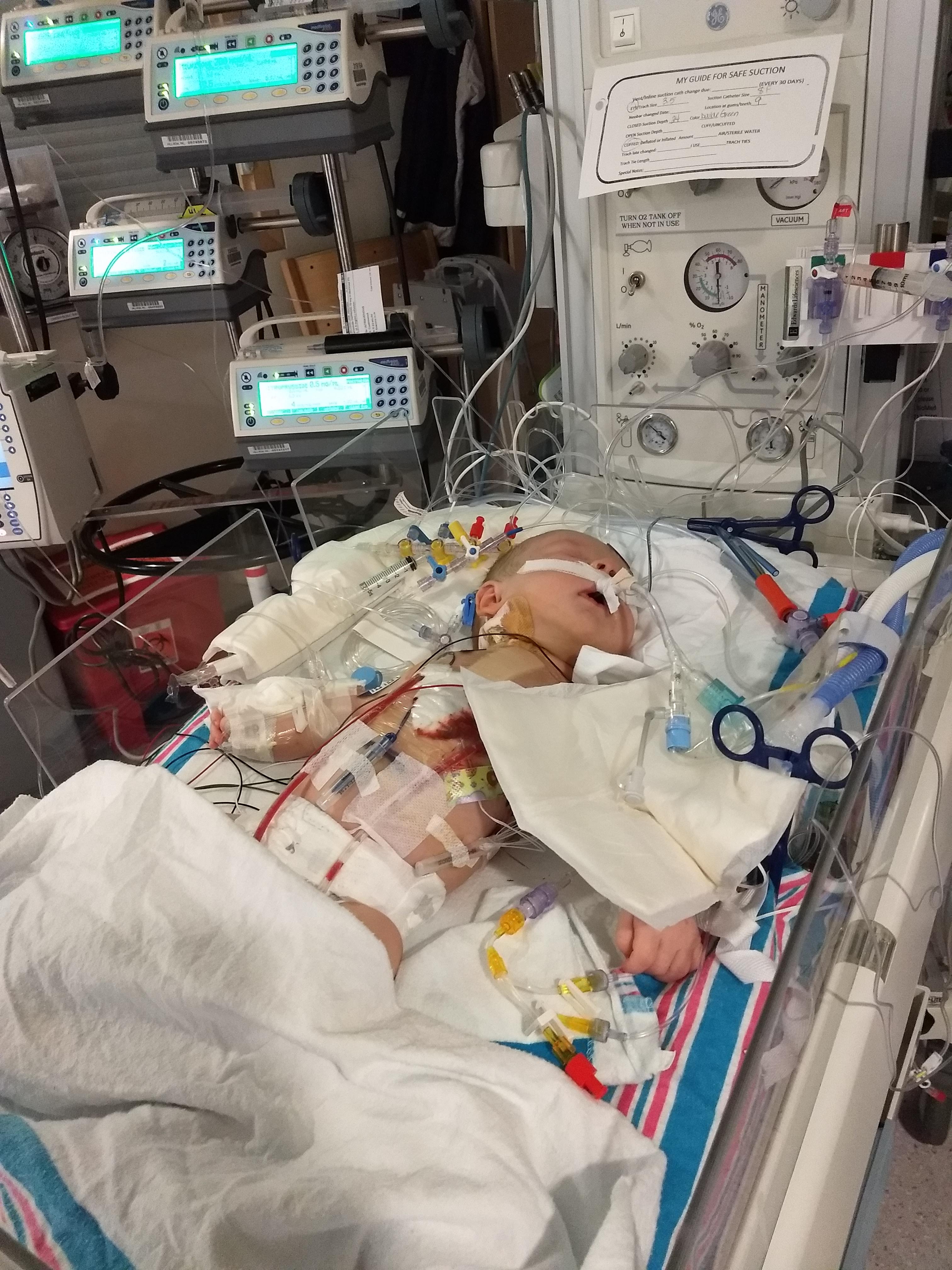 Open Heart Surgery 2/6/19