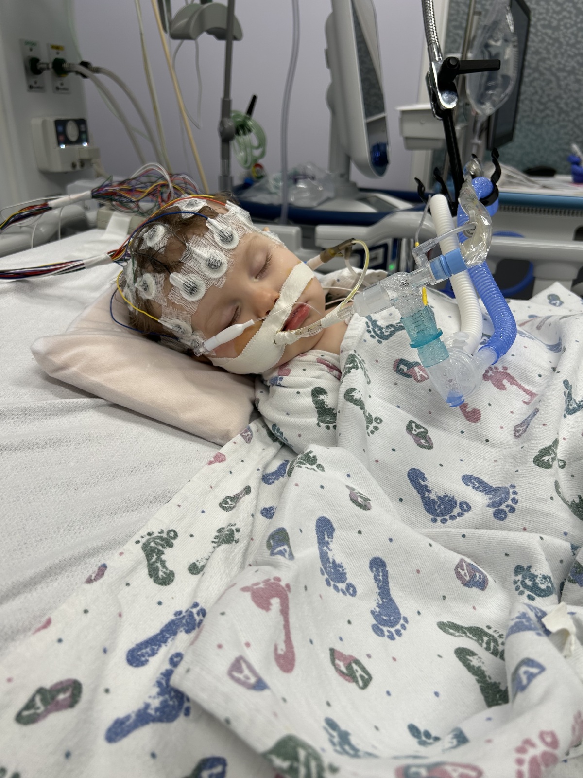 Rory’s first intubation