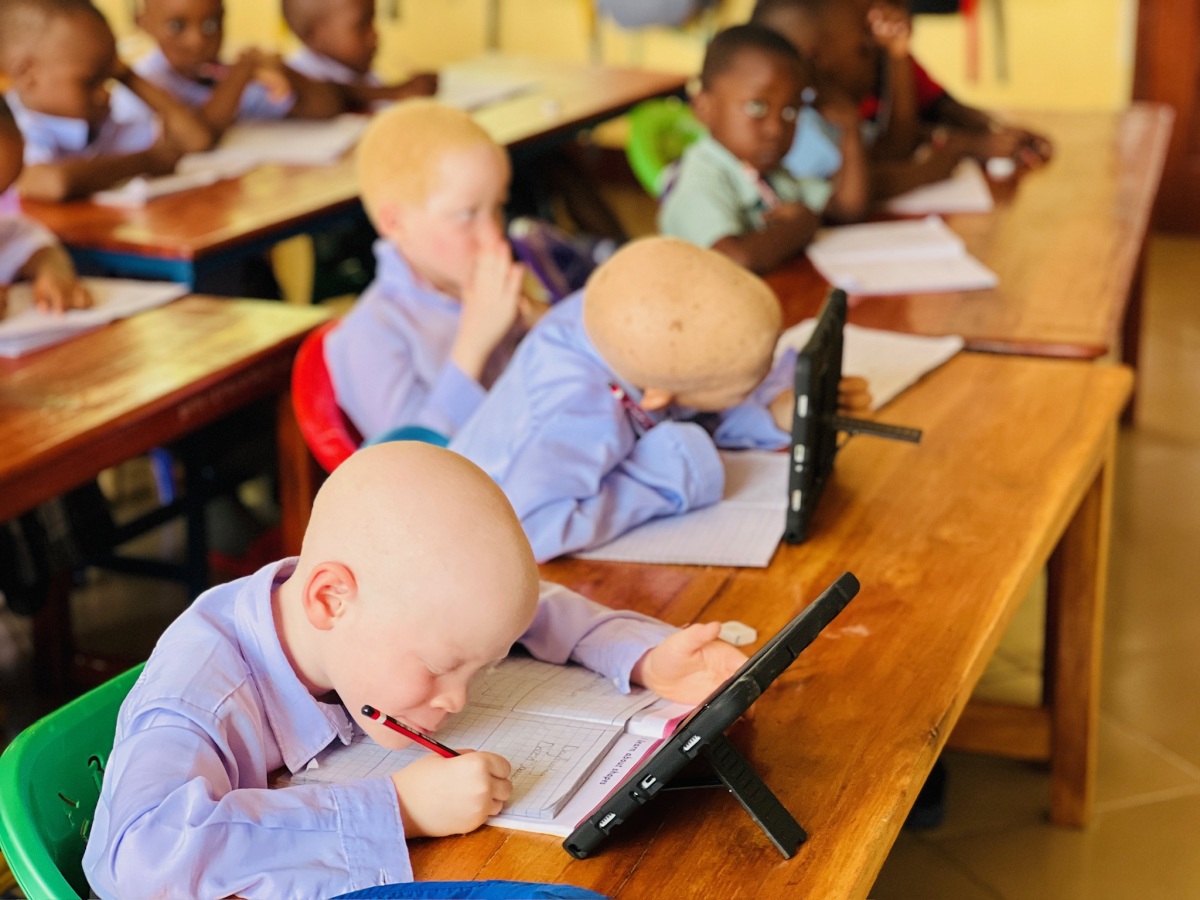 Students with albinism using adaptive tools to accomodate for low vision