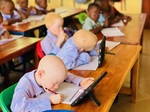 Students with albinism using adaptive tools to accomodate for low vision