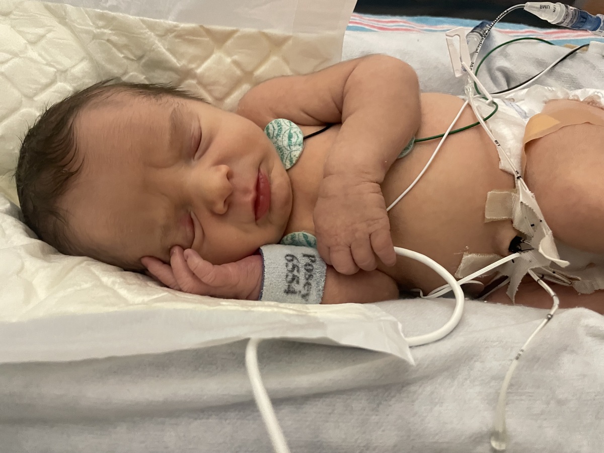 The NICU Days Before the CVICU Transfer