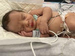 The NICU Days Before the CVICU Transfer