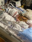 1st time on ECMO