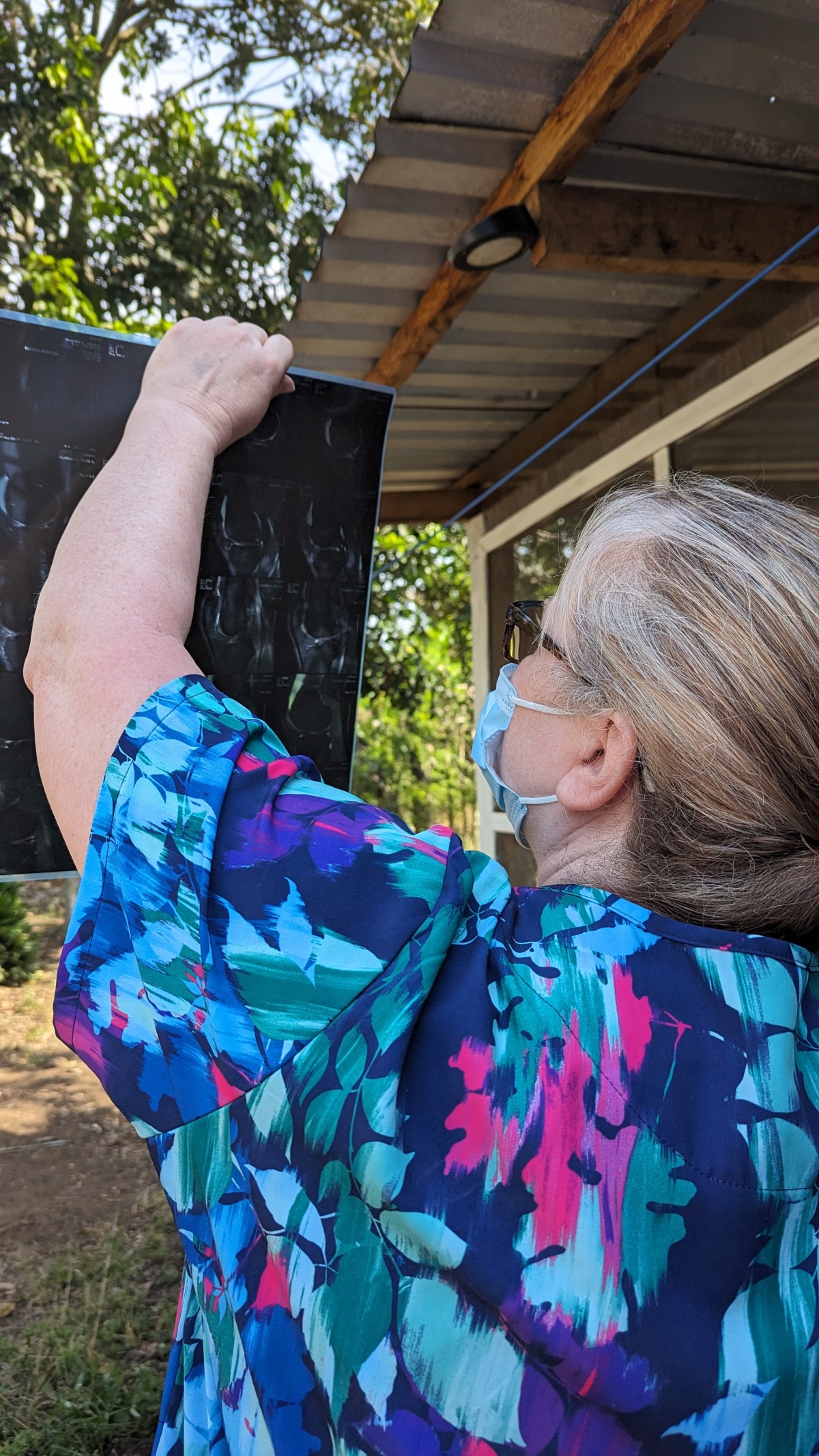 We even check out the MRI when provided. No view box available in Honduras. Just God's sunshine.
