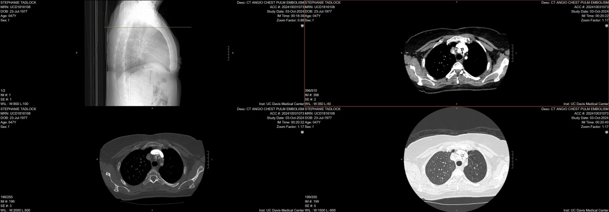 The first scan