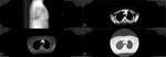 The first scan