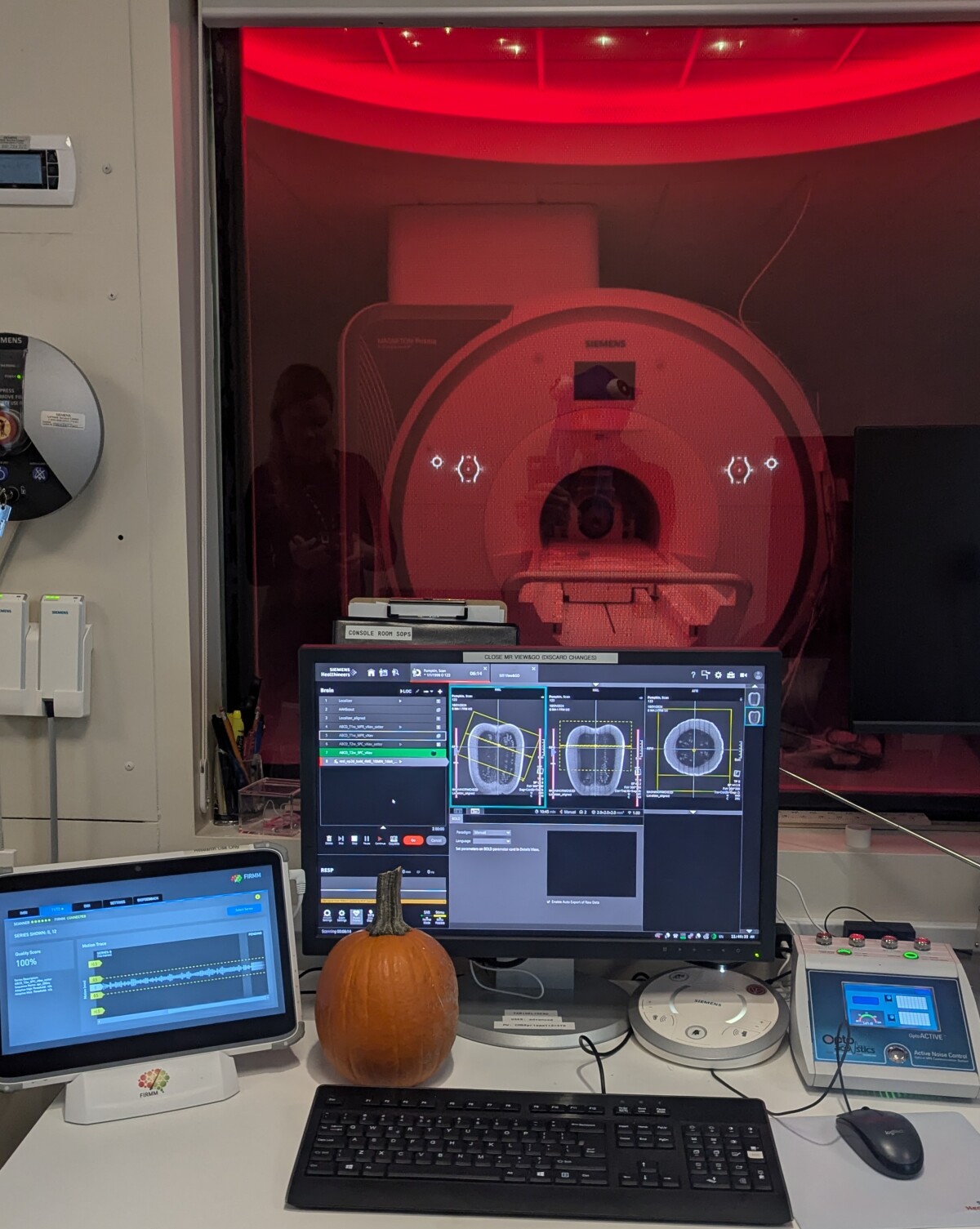 We scanned a pumpkin!