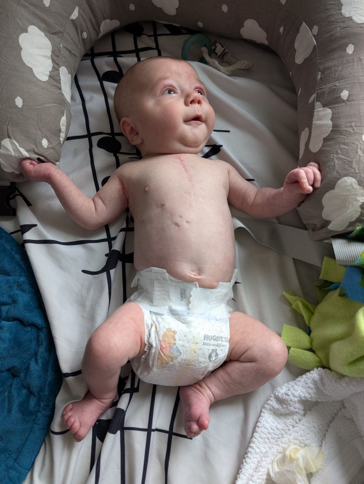 Look at the healing scar!