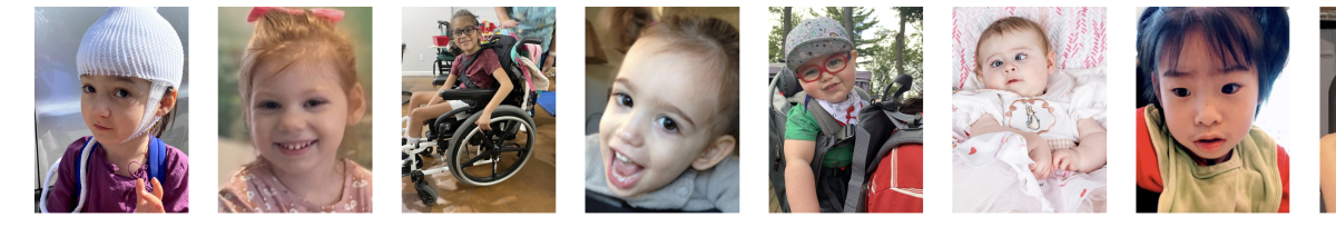 Every Sponsorship is a Gift of Hope - Helping to Bring a Treatment to FOXG1 Children 