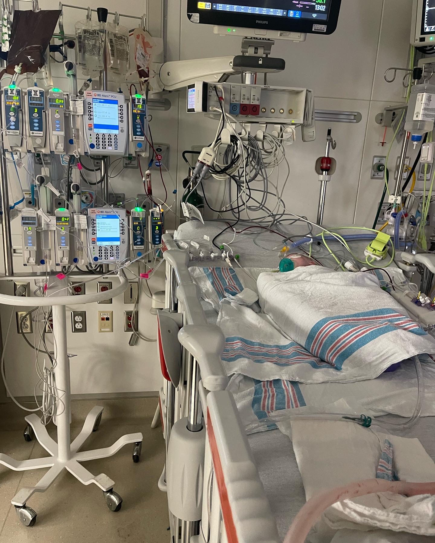 open heart surgery post op day 0