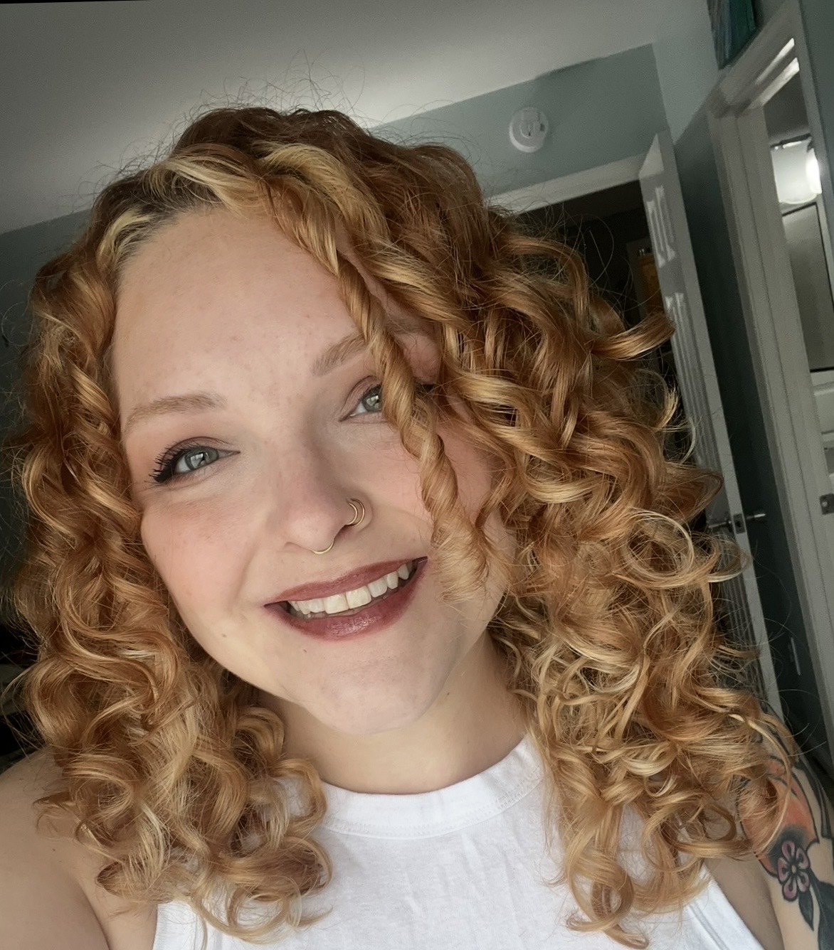 Stephanie's histio story