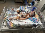 Post-open heart surgery (Feb 2025)
